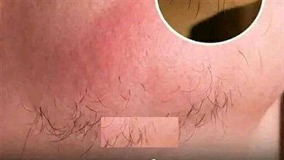 لمحة نيوز