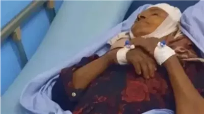خالتي اتحـللت وعـفنت وهي عايشة والسبب خـطير